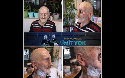 Bir Sivilce Ne Hale Getirdi ( GERÇEK HAYATLAR )