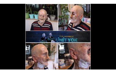 Bir Sivilce Ne Hale Getirdi ( GERÇEK HAYATLAR )